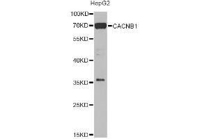 Western blot analysis of extracts of HepG2 cells, using CACNB1 Antibody (ABIN2736384) at 1:1000 dilution. (CACNB1 anticorps)