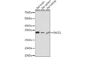 Western blot analysis of extracts of various cell lines, using R Rabbit mAb (ABIN1679360, ABIN3018118, ABIN3018119 and ABIN7101576) at 1:1000 dilution. (GNB2L1 anticorps)