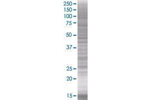 RAB33B transfected lysate. (RAB33B 293T Cell Transient Overexpression Lysate(Denatured))