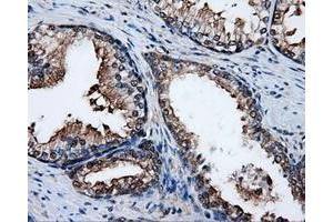 Immunohistochemistry (IHC) image for anti-Proteasome (Prosome, Macropain) 26S Subunit, ATPase, 3 (PSMC3) antibody (ABIN1501329) (PSMC3 anticorps)