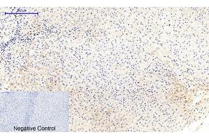 Immunohistochemical analysis of paraffin-embedded human liver tissue. (MEK1/2 anticorps  (pSer218, pSer222))