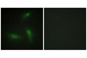 Immunofluorescence analysis of HeLa cells, using hnRNP A1 antibody. (HNRNPA1 anticorps  (Internal Region))