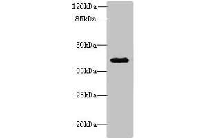 Western blot All lanes: DCN antibody at 6 μg/mL + Jurkat whole cell lysate Secondary Goat polyclonal to rabbit IgG at 1/10000 dilution Predicted band size: 40 kDa Observed band size: 40 kDa (Decorin anticorps  (AA 31-360))