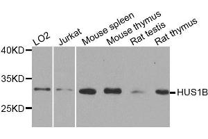 Western blot analysis of extracts of various cell lines, using HUS1B antibody. (HUS1B anticorps  (AA 1-278))