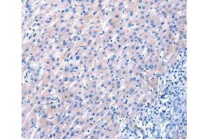 Immunohistochemistry (IHC) image for anti-Epidermal Growth Factor (EGF) antibody (ABIN6219771) (EGF anticorps)