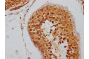 IHC image of ABIN7127796 diluted at 1:100 and staining in paraffin-embedded human testis tissue performed on a Leica BondTM system. (Recombinant RNF2 anticorps)