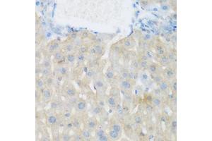 Immunohistochemistry of paraffin-embedded mouse liver using EGFR antibody (ABIN5997650) at dilution of 1/100 (40x lens). (EGFR anticorps)