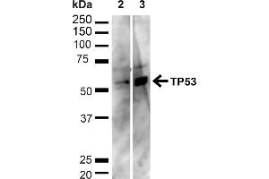 Western blot analysis of Human HeLa and HEK293T cell lysates showing detection of ~43. (p53 anticorps  (C-Term) (HRP))