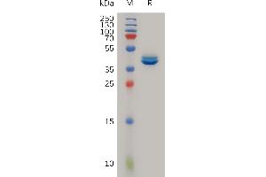 Human Protein, hFc Tag on SDS-PAGE under reducing condition. (CCL2 Protein (AA 24-99) (Fc Tag))