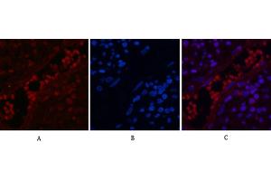 Immunofluorescence analysis of human appendix tissue. (NF-kB p65 anticorps  (acLys310))