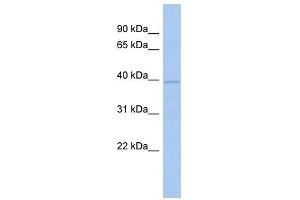 FLJ33790 antibody used at 1 ug/ml to detect target protein. (FLJ33790 (N-Term) anticorps)