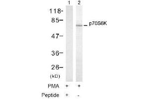 Image no. 1 for anti-Ribosomal Protein S6 Kinase, 70kDa, Polypeptide 1 (RPS6KB1) (Thr421) antibody (ABIN197499) (RPS6KB1 anticorps  (Thr421))