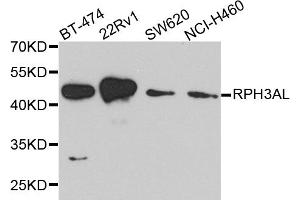 Western blot analysis of extracts of various cell lines, using RPH3AL antibody. (RPH3AL anticorps)