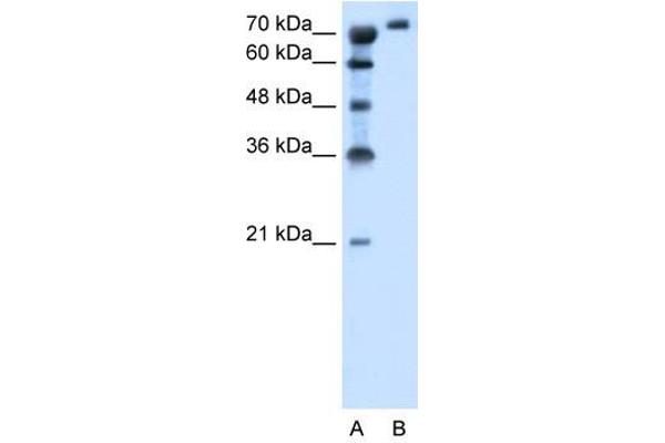 SLC6A18 anticorps  (Middle Region)