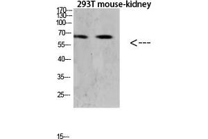 Western blot analysis of Hela lysate, antibody was diluted at 1:1000. (TNFRSF11A anticorps  (AA 60-120))