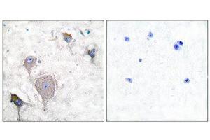 Immunohistochemistry (IHC) image for anti-Peripherin (PRPH) (C-Term) antibody (ABIN1848741) (Peripherin anticorps  (C-Term))