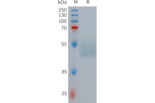 GIPR Protein (AA 22-138) (Fc Tag)