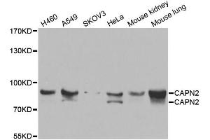 Western blot analysis of extracts of various cell lines, using CAPN2 antibody (ABIN5975337) at 1/1000 dilution. (Calpain 2 anticorps)
