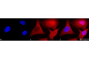 Immunocytochemistry/Immunofluorescence analysis using Mouse Anti-Ubiquitin Monoclonal Antibody, Clone 6C11-B3 . (Ubiquitin anticorps  (Atto 594))