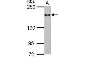 WB Image Sample (30 ug of whole cell lysate) A: THP-1 5% SDS PAGE antibody diluted at 1:2000 (ITGAL anticorps  (Internal Region))