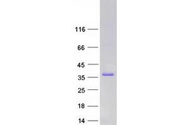 CEACAM19 Protein (Transcript Variant 1) (Myc-DYKDDDDK Tag)