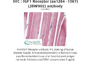 Image no. 1 for anti-Insulin-Like Growth Factor 1 Receptor (IGF1R) (AA 1264-1367) antibody (ABIN1723400) (IGF1R anticorps  (AA 1264-1367))