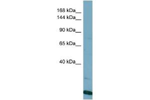 Host:  Rabbit  Target Name:  VPS8  Sample Type:  HT1080 Whole Cell lysates  Antibody Dilution:  1. (VPS8 anticorps  (N-Term))