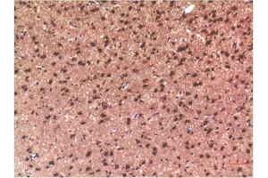 Immunohistochemical analysis of paraffin-embedded Rat Brain Tissue using Tau Mouse mAb diluted at 1:200. (tau anticorps)