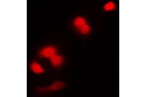 Immunofluorescent analysis of CDC2 staining in K562 cells. (CDK1 anticorps  (Center))