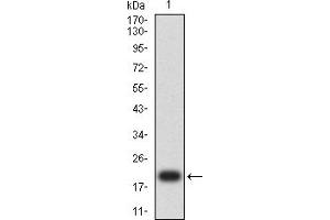 Western blot analysis using MDM2 mAb against human MDM2 (AA: 26-169) recombinant protein. (MDM2 anticorps  (AA 26-169))