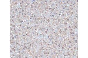 Immunohistochemistry of paraffin-embedded Rat liver using SNW1 Polyclonal Antibody at dilution of 1:100 (40x lens). (SNW1 anticorps)