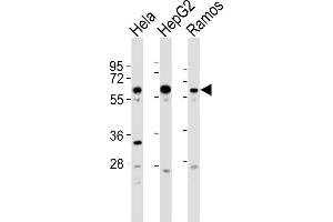 All lanes : Anti-GRK5 Antibody  at 1:2000 dilution Lane 1: Hela whole cell lysates Lane 2: HepG2 whole cell lysates Lane 3: Ramos whole cell lysates Lysates/proteins at 20 μg per lane. (GRK5 anticorps  (C-Term))