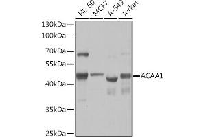 Western blot analysis of extracts of various cell lines, using  Rabbit pAb  at 1:1000 dilution. (ACAA1 anticorps  (AA 27-300))