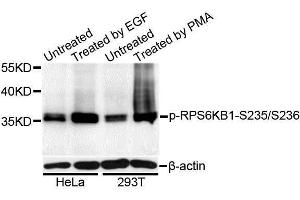Western blot analysis of extracts of HeLa and 293T cells, using Phospho-RPS6KB1-S235/236 antibody (ABIN5995796) at 1/1000 dilution. (RPS6 anticorps  (pSer235, pSer236))