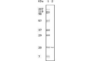 Western blot analysis using CD19 mouse mAb against CD19 recombinant protein. (CD19 anticorps)