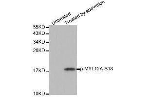 Western blot analysis of extracts from 293 cells untreated or treated with starvation using Phospho-MYL12A-S18 antibody (ABIN2988196). (MYL12A anticorps  (pSer18))