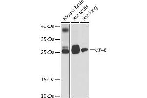 Western blot analysis of extracts of various cell lines, using eIF4E antibody (ABIN6134340, ABIN6140083, ABIN6140085 and ABIN6221700) at 1:1000 dilution. (EIF4E anticorps  (AA 1-100))