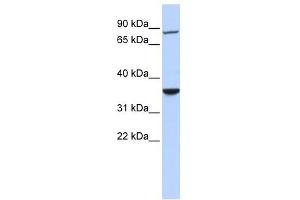 RNF207 antibody used at 1 ug/ml to detect target protein. (RNF207 anticorps  (N-Term))