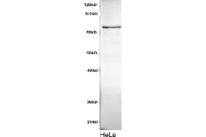 Western Blotting (WB) image for anti-Cadherin 8 (CDH8) antibody (ABIN5958176) (Cadherin 8 anticorps)