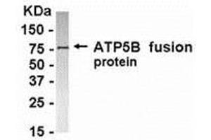 Western Blotting (WB) image for anti-ATP Synthase, H+ Transporting, Mitochondrial F1 Complex, beta Polypeptide (ATP5B) (AA 291-539) antibody (ABIN2468164) (ATP5B anticorps  (AA 291-539))