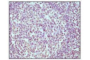 Immunohistochemical analysis of paraffin-embedded human normal lymph node, showing cytoplasmic localization using CD19 mouse mAb with DAB staining. (CD19 anticorps)