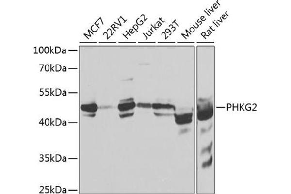 PHKG2 anticorps  (AA 237-406)