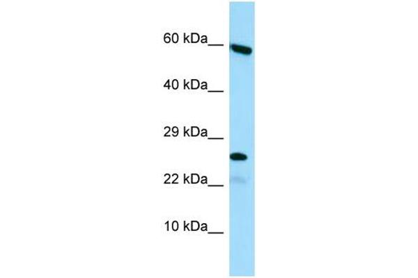 HGSNAT anticorps  (N-Term)