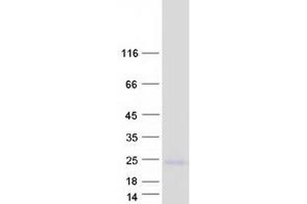 SMAGP Protein (Transcript Variant 2) (Myc-DYKDDDDK Tag)