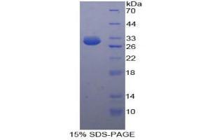SDS-PAGE (SDS) image for Hexokinase 3 (White Cell) (HK3) (AA 673-903) protein (His tag) (ABIN1878889) (HK3 Protein (AA 673-903) (His tag))