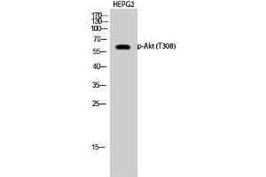 Western Blotting (WB) image for anti-V-Akt Murine Thymoma Viral Oncogene Homolog 1 (AKT1) (pThr308) antibody (ABIN3182380) (AKT1 anticorps  (pThr308))
