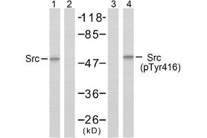 Western blot analysis of extracts from COLO205 cells using Src (Ab-418) antibody (E021115, Lane 1 and 2) and Src (phospho-Tyr418) antibody (E011091, Lane 3 and 4). (Src anticorps)