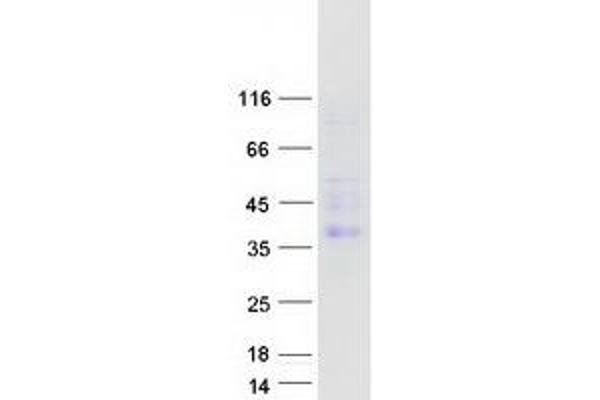 CEACAM4 Protein (Myc-DYKDDDDK Tag)