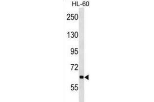 Western Blotting (WB) image for anti-Ankyrin Repeat and KH Domain Containing 1 (ANKHD1) antibody (ABIN2998597) (ANKHD1 anticorps)