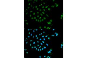 Immunofluorescence analysis of MCF-7 cells using XRCC2 antibody (ABIN5970910). (XRCC2 anticorps)